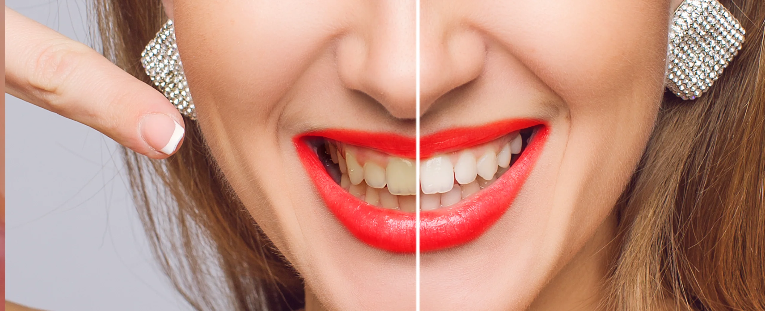 Zahnfarbe (Welche Zahnfarbe ist die richtige?)